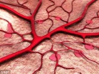 保護血管-保護血管三大要素及八大健康飲食:清除血管垃圾消除血栓軟化血管彈性!